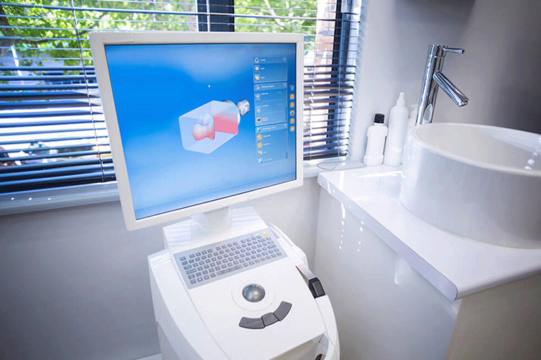 itero_digital_scanner